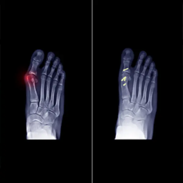 Complex-Neglected-Trauma-Management
