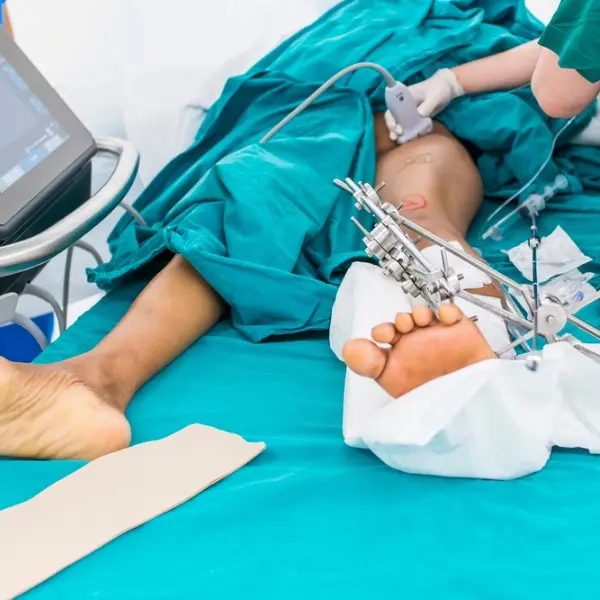 Ilizarov-Limb-Reconstruction-Surgery