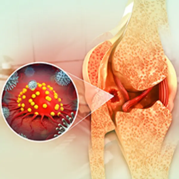 Musculoskeletal-Tumor-Surgery