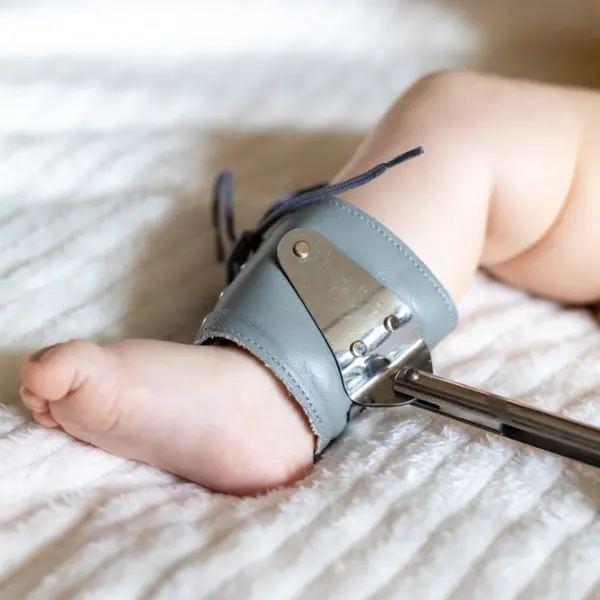 Pediatric-Orthopedics